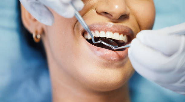 Best Weekend Emergency Dentist in Brier, WA